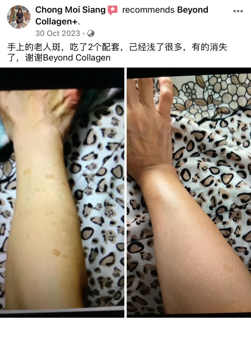 Body & Skin — Beyond Collagen+ testimonial